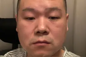 知名导演炮轰岳云鹏：装疯卖傻又老又丑，他能走红是娱乐圈的悲哀图片
