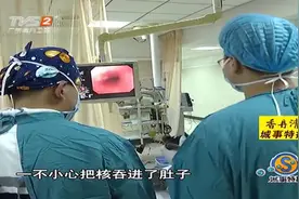 男子误吞菠萝蜜果核，本束手无策，结果医生想出奇招成功钳出果核视频封面