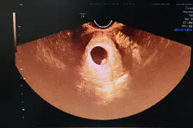 「小探头 大作为」这些孕期超声检查，准妈妈千万不能错过图片