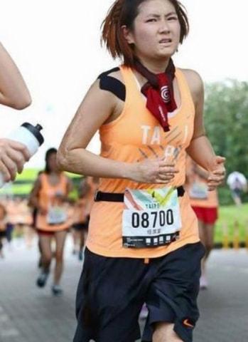 she烧伤 she烧伤照片 事件(图2)