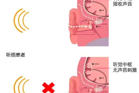 听不见却迟迟不配助听器，这5个顾虑耽误了你图片
