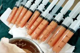 被称为人体“软黄金”的脂肪，不仅可以美了脸，而且还增大了胸图片