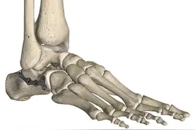 足跟痛定位及诊断要素图片