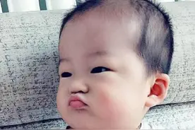 1岁宝宝总撅“金鱼嘴”，宝妈晒照夸可爱，医生朋友：赶紧送医院图片