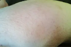 猪身上有疙瘩什么治疗图片