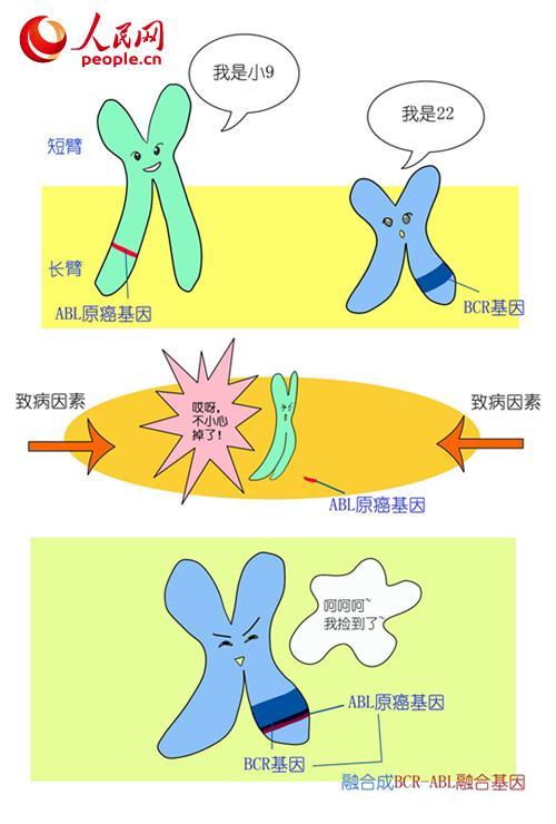 从染色体、基因说起 带你了解“慢性粒细胞白血病”
