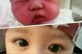 产科护士：刚出生婴儿这3个地方越丑，长大越好看，网友：真准图片