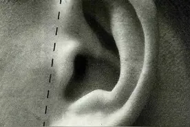 提拉耳朵，去皱纹图片