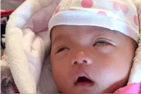 宝宝睡觉翻白眼怎么回事？原来是因为这个原因图片