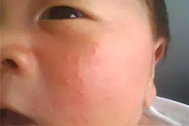 新生儿的皮肤护理指南，这几大常见的皮肤问题处理方法，可要收好图片