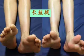长短腿？这4个形成因素，你是不是也中招了图片