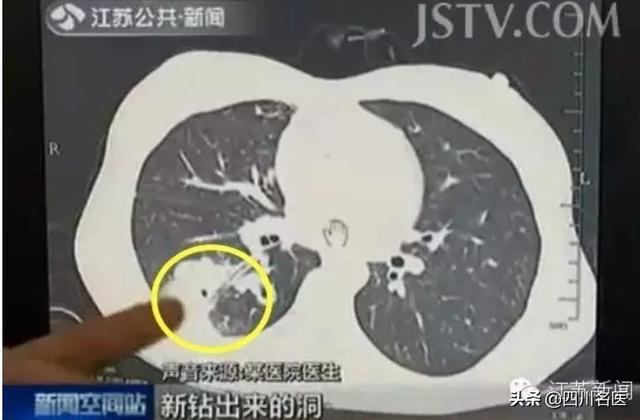 鱼鳞扁平白色多爪寄生虫