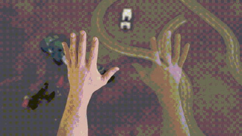 不存在的肢体又痛又痒，是断肢阴魂不散还是全靠想象？图片