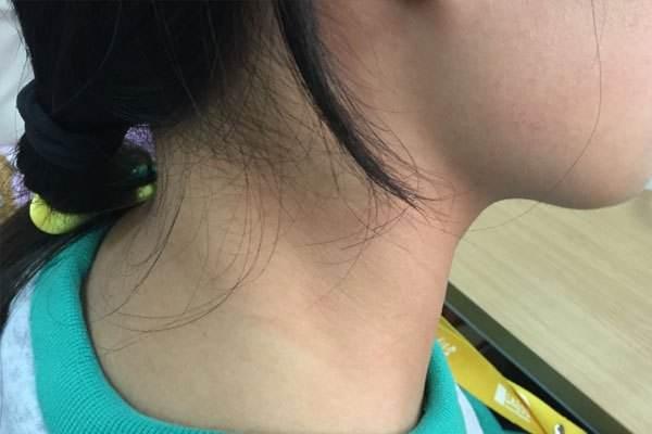 鑴栧瓙鍜岃劯鑹插樊澶ぇ锛屼笂濡嗛兘琛ユ晳涓嶄簡锛熼閮ㄦ姉榛戞姉鐨卞疄鐢ㄦ寚鍗? onerror=