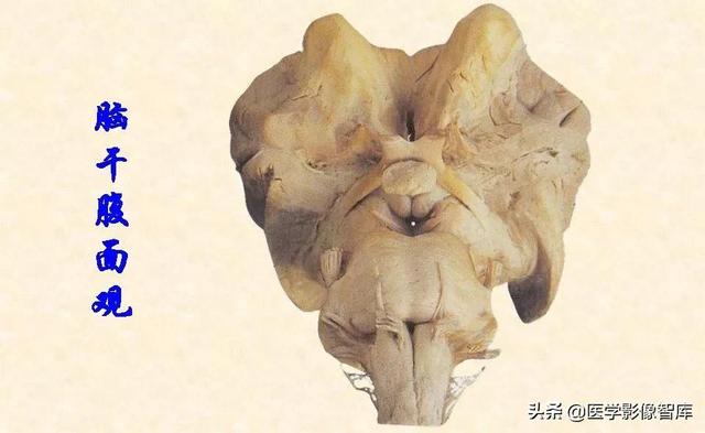 脑干、小脑及间脑解剖