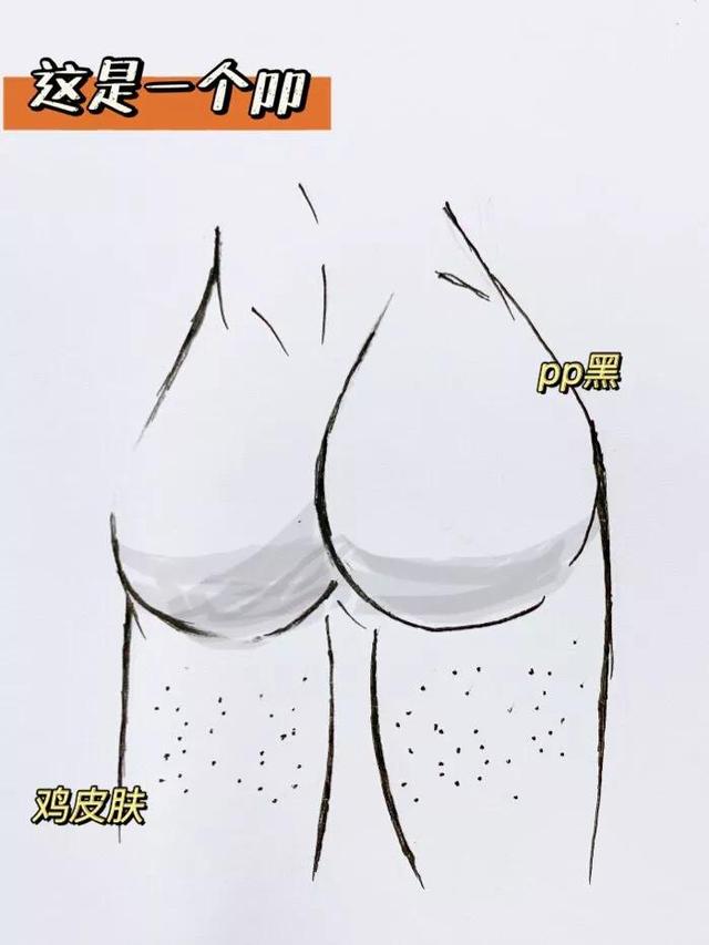 屁股很黑很多鸡皮疙瘩