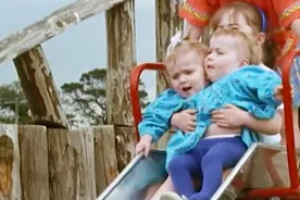 2女孩共用一个躯体生活3年，要将她们个体分离，能成功吗？图片