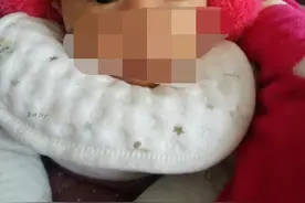 为避免娃遗传老公眯眯眼，孕妈“狂”吃葡萄，孩子出生后怀疑抱错图片