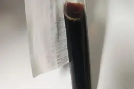 运动过量连续三天出现酱油色尿，医生提醒：减肥心切也要循序渐进图片
