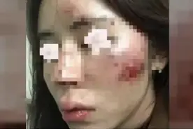 女子深夜遭3名陌生男子滋扰殴打，2名嫌疑人已被抓获图片