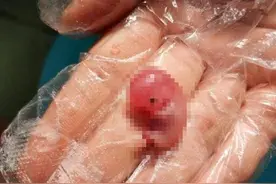 60天的“胎儿”流产出来的样子，看完让人难过！网友：不忍心看图片