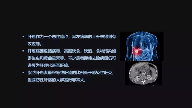 贾伟：肝病肠治？且看肠道细菌如何对肝病推波助澜