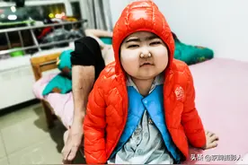 小帅哥吃完药变成大胖子，妈妈：家里不能有镜子，看着难受图片