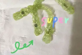 戴牙套接吻却不小心勾到一起了，这尴尬程度爆表了图片