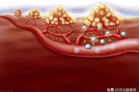 微循环畅通无阻，让心血管疾病绕道走图片