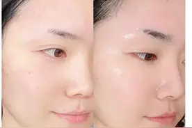 经常熬夜脸色蜡黄？这样做可以改善暗沉的脸色图片