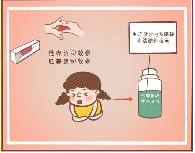 湿疹反复发作瘙痒难耐，医生提醒：不妨试试这个方法