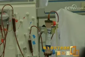 疫情下的武汉血透患者：“不透析，我们的存活率是零”图片