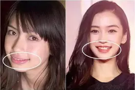明星整牙前后的对比，堪比整容，看完你就知道牙齿有多么重要图片