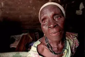 曾经肆虐非洲的盘尾丝虫，号称眼球杀手，已被预测于2020年消失图片