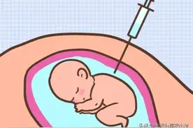 羊水穿刺到底有多疼—记录我产检过程中最煎熬的过程图片