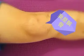 “因为膝关节痛，我把老房子换成了电梯房”，十问髌股关节炎图片
