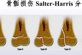 儿童骨骺骨折的诊疗原则图片