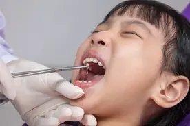 扔了吧！这种网红儿童牙刷越刷越脏，很多家长还在给娃用图片