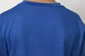 孩子经常脖子往一边歪斜，颈部硬块突起是肌肉损伤，应该如何治疗图片