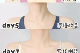 5步get少女背、直角肩｜改善斜方肌教程❗️养出天鹅颈❗️图片