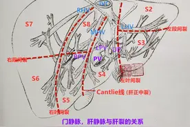 胆囊解剖，太清晰了图片