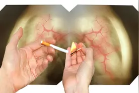 还吸吗？吸烟导致血栓闭塞性脉管炎图片