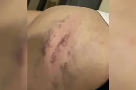 南宁情侣酒后互殴，女子被男友用铁棍追着打图片