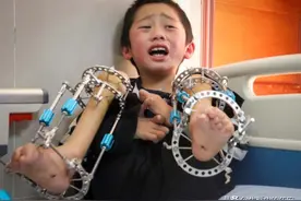 孕妈生出个残疾儿子，竟又冒险生二胎，孩子出生后父母愧疚不已图片