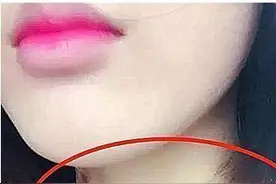 13岁女孩脖子上“草莓印”瞩目，父母质问缘由，孩子的回答很心酸图片