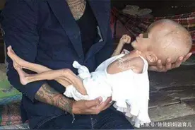 多名婴儿变“大头娃娃”堪比12年前三鹿奶粉事件，网友：不能原谅图片