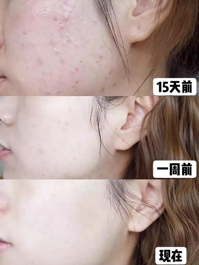 鐩存挱娲楄劯绔熸垚浜嗘槑鏄熸姠娴侀噺鐨勭粷鎷涳紒姘ㄥ熀閰告场娉℃磥闈紝绱犻鏇磋嚜淇? onerror=