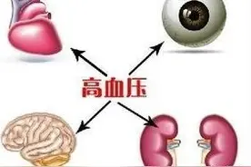 得了高血压，还能活多久？图片