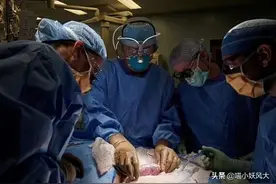 猪肾移植人体成功！为什么用猪器官，和人类最近的不是猩猩吗？图片