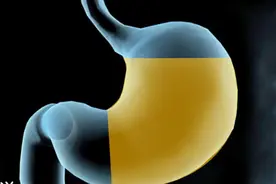 胃癌好发于胃的哪些部位？医生说这一部位高发